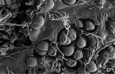 By Zettler - http://biochemistri.es/post/54822597074/microscopic-fragments-of-plastic-in-the-oceans, CC BY-SA 4.0, https://commons.wikimedia.org/w/index.php?curid=45092277